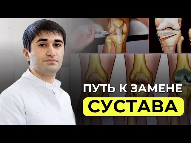 Как спасти колено от разрушения: откройте секрет восстановления суставов!