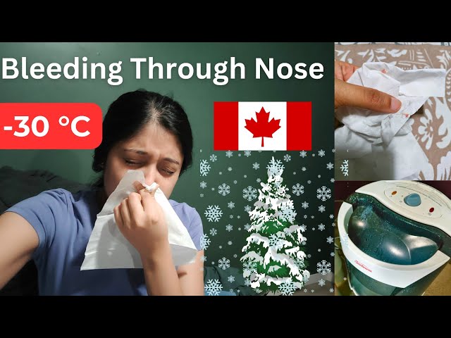 Bleeding Through Nose | Canada Winter | Low Humidity #canada #nosebleed #canadianwinter #depression