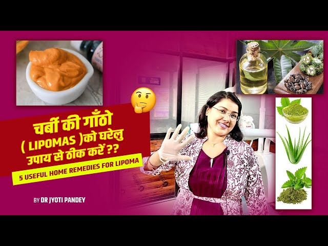 चर्बी की गाँठो( Lipomas )को घरेलु उपाय से ठीक करें || 5 useful Home Remedies for Lipoma..