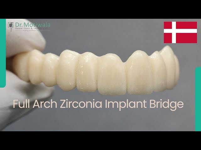 Jesper from Denver gives a 9 years review of Full Mouth Dental Implant in India | Zirconia Bridge