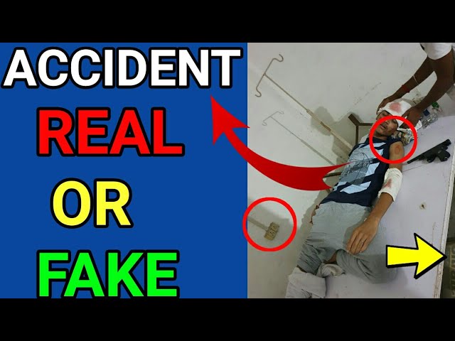 Anurag dwivedi accident | anurag dwivedi accident real or fake | Anurag dwivedi dream 11