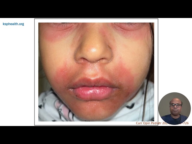 Pediatric Dermatologic Emergencies - Part 1