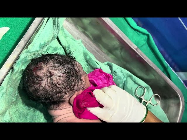 Cute Cute Cute Cute Little Baby CuteLittle #Bantubabycare#viralvideo #baby #cutebaby#cute #trending