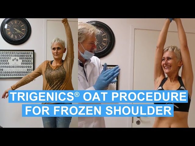 FROZEN SHOULDER CURE: Professional Musician from Switzerland Gets Her Shoulder Back!