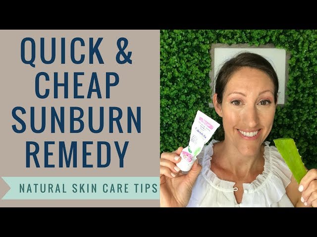 Natural DIY Sunburn, Minor Burn and Radiation Burn Home Remedies | Heal SUNBURNS Overnight & Fast