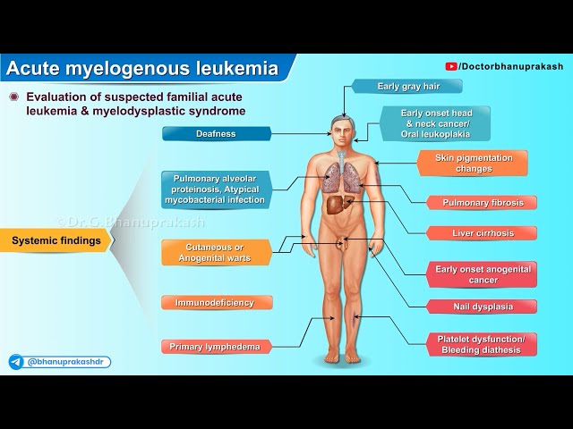 Acute Myelogenous Leukemia : Part 1 (Histopathology, AML In Down Syndrome, Evaluation of AML)