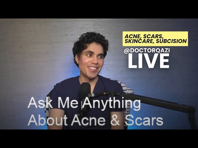 Dr. Qazi discusses Acne, Scars, Skincare, Subcision | Dr. Qazi Unsponsored Live | 2.13.2025