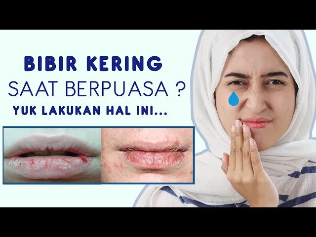 Tips Mengatasi Bibir Kering Saat Berpuasa