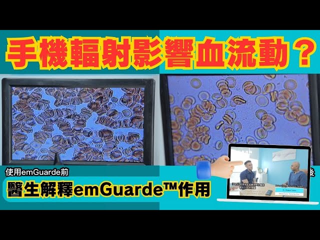 醫生Dr.Roland解釋emGuarde作用（中文字幕）| Mark Interviews Dr.Roland on EMR #emguarde #enagic #輻射