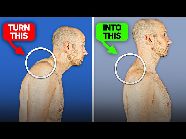 Fix Your Neck Hump FAST (10 Minutes a Day)