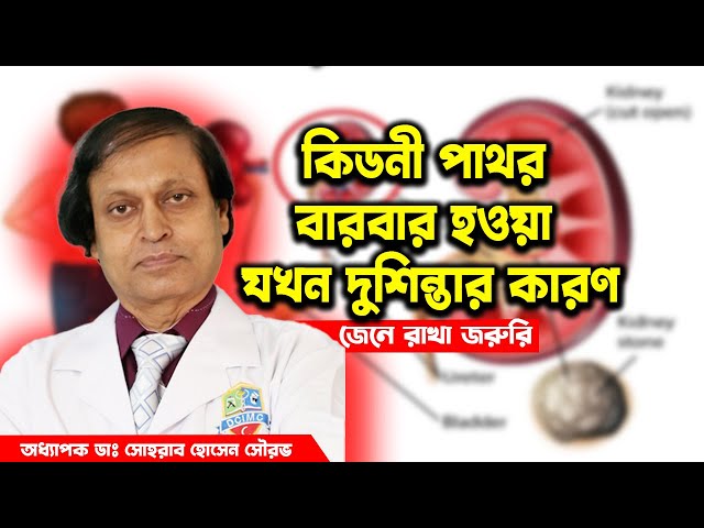 কিডনী পাথর বারবার হওয়া যখন দুশিন্তার কারণ।হাসপাতাল