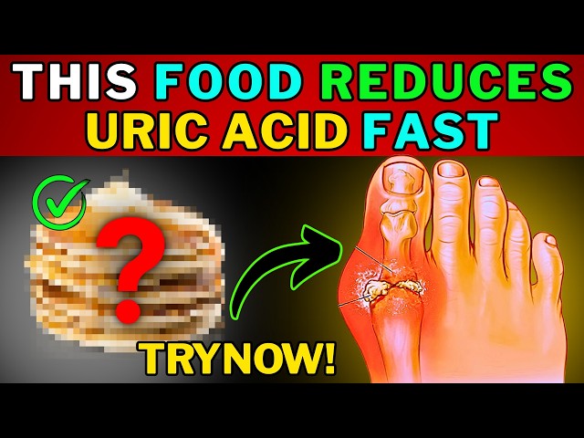 Eat These Foods to Lower Uric Acid FAST