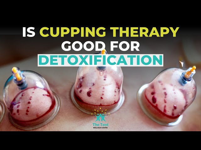 How Cupping Therapy Supports Pain Relief and Detox