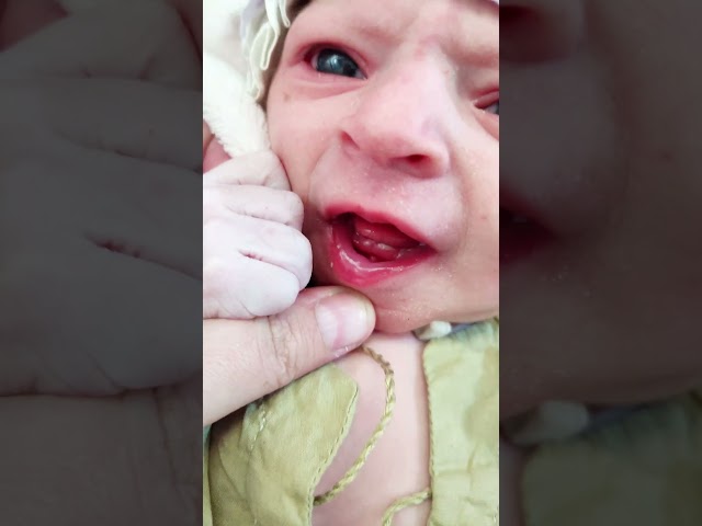 Cutest Newborn Baby born with teeth A Rare Video @AfterBirth