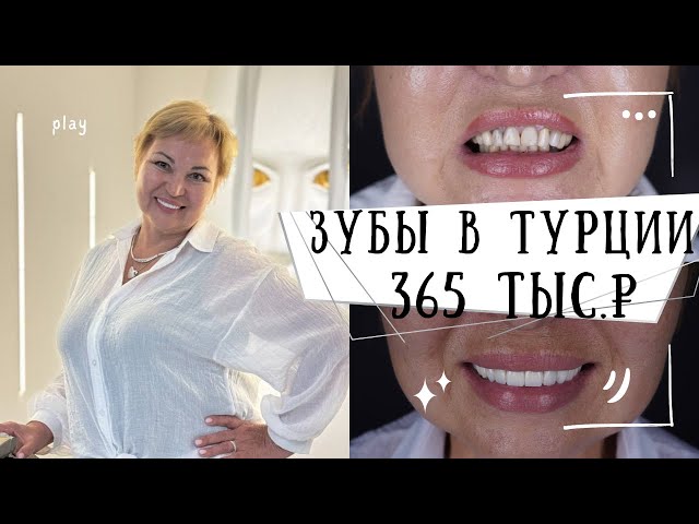 ЗУБЫ В ТУРЦИИ - 365 тыс.₽ - ВЕСЬ РОТ КОРОНКИ НЕМЕЦКИЙ ЦИРКОНИЙ И 2 ИМПЛАНТА за 6 дней