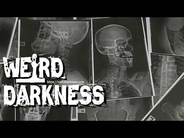 FREAKY AND CREEPY TRUE MEDICAL CASES YOU’LL FIND IT HARD TO BELIEVE! #WeirdDarkness