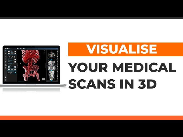 3Dicom for Patient Education - 3D Medical Image Viewer