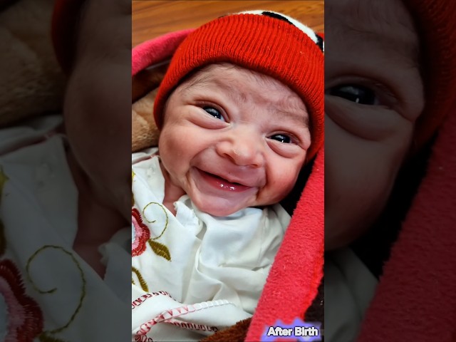 Amazing Smile of Cutest Newborn Baby @AfterBirth