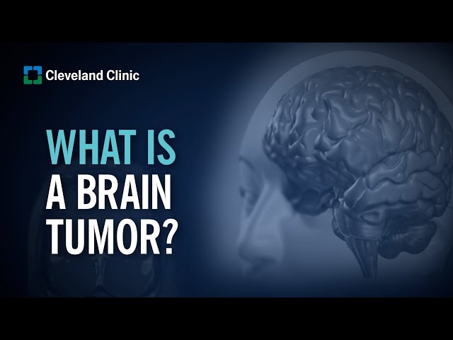 Primary Brain Tumors | What Are They and How Do They Form?