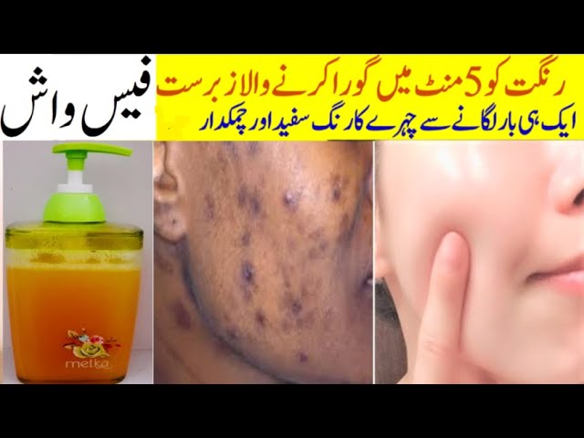 Homemade Face Wash For Pimples & Acne and get glowing skin in just i use diy face wash for all skin