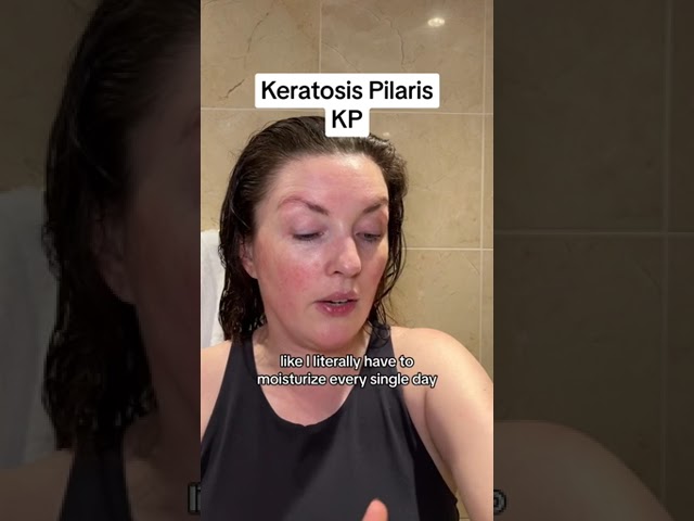 How do you get rid of Keratosis Pilaris KP? #keratosispilaris #skincare