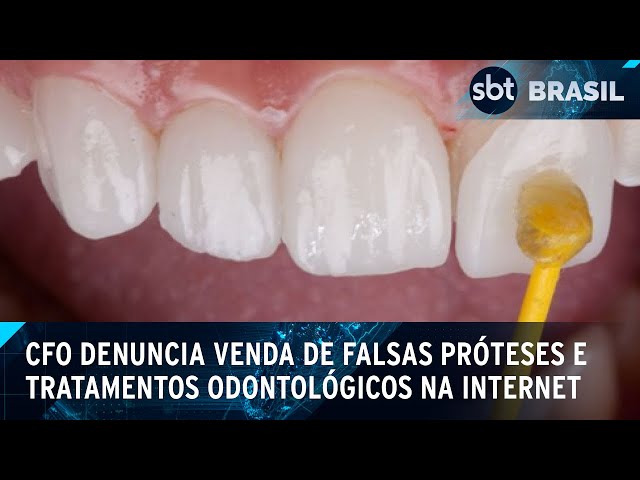 Venda de resinas em e-commerce é alvo de denúncia do Conselho de Odontologia | SBT Brasil (08/02/25)