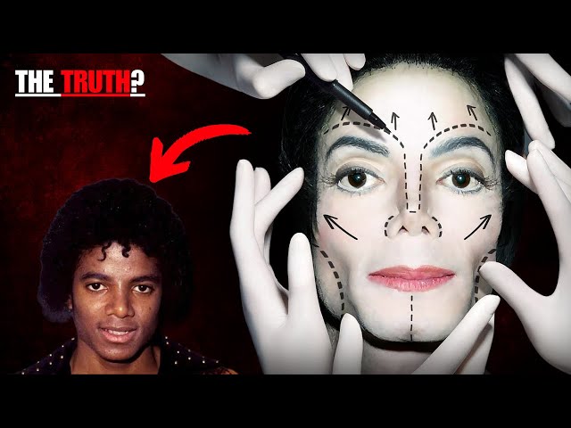 The Shocking Reality Behind Michael Jackson's Plastic Surgery