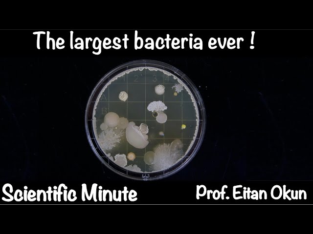 The largest bacteria ever found | Scientific minute