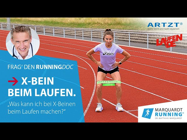 Frag den RunningDoc – Laufwissen. Folge 16: X-Bein beim Laufen