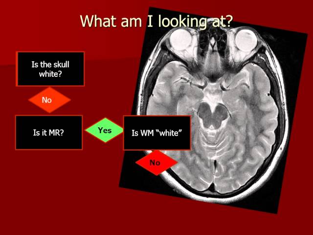 Introduction to Imaging: What am I looking at?