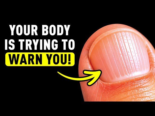 Check Your Nails to Uncover the TRUTH About You 🤚