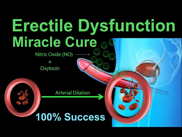 Erectile Dysfunction Successful Natural Miracle Cure