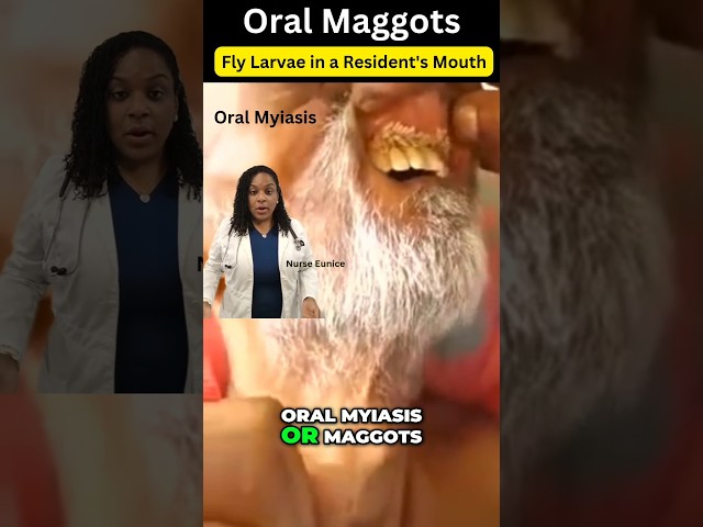 🦠 Oral Myiasis: Maggots in the Mouth?! 🦟