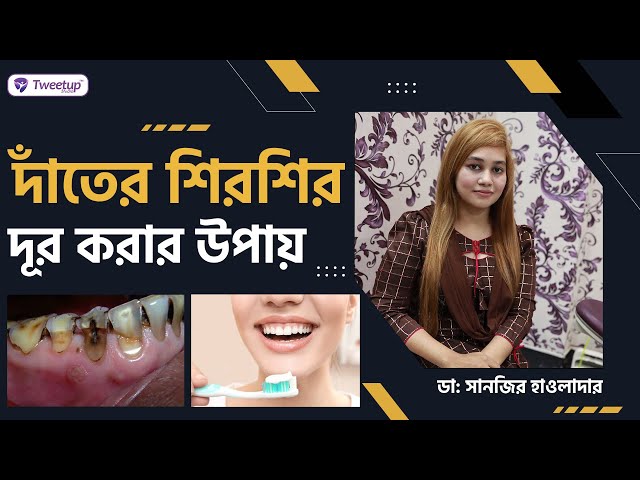 দাঁতের শিরশিরানি দূর করার উপায়।। Ways to get rid of dental caries (4k)