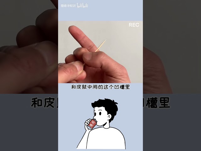 弹指飞针虽然很酷炫，但是不要乱用哦#科普一下 #飞针手法