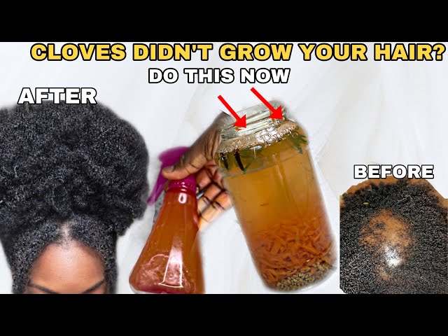 I wish I used this earlier,now my hair can’t stop growing!how I grew my hair fast wit the new cloves