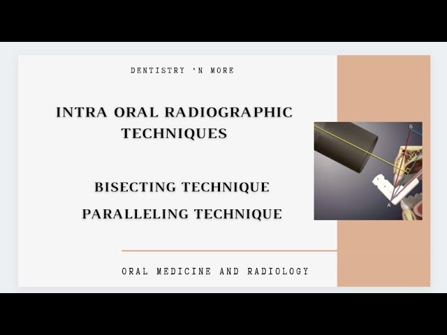 INTRA ORAL RADIOGRAPHIC TECHNIQUES