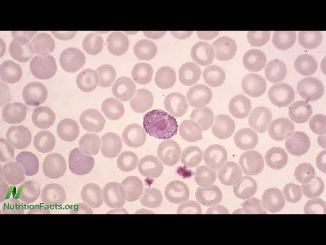 What Does a Low White Blood Cell Count Mean?