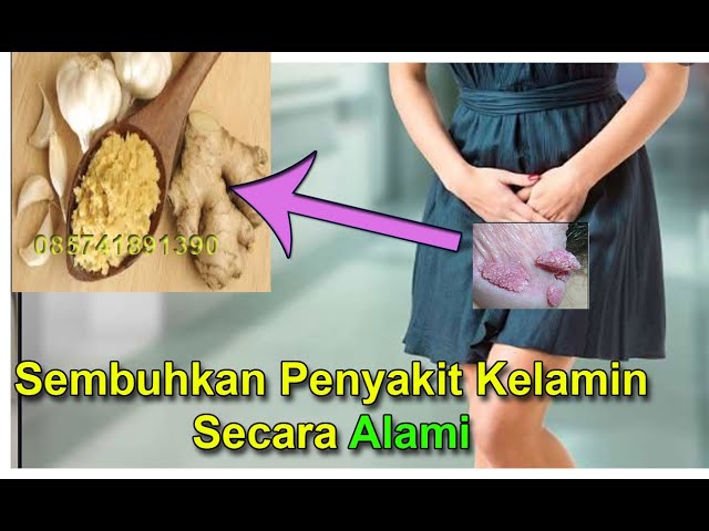 Cara Menyembuhkan Penyakit Kelamin Secara Alami - Obat Kutil Kelamin Herbal #085741891390