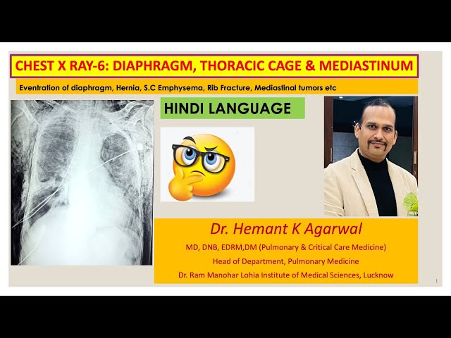 Radiology- Chest X Ray:6, (HINDI) Diaphragm, Chest wall and Mediastinum@Dr. Hemant K Agarwal