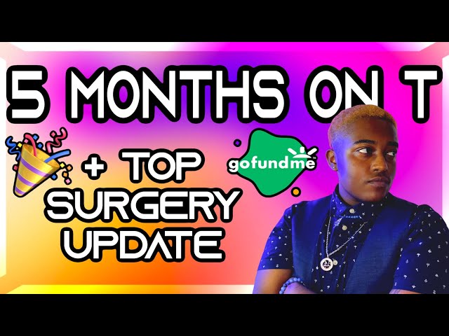 Top Surgery Update (5 MONTHS ON T) | Black/Afro-Caribbean Trans Man