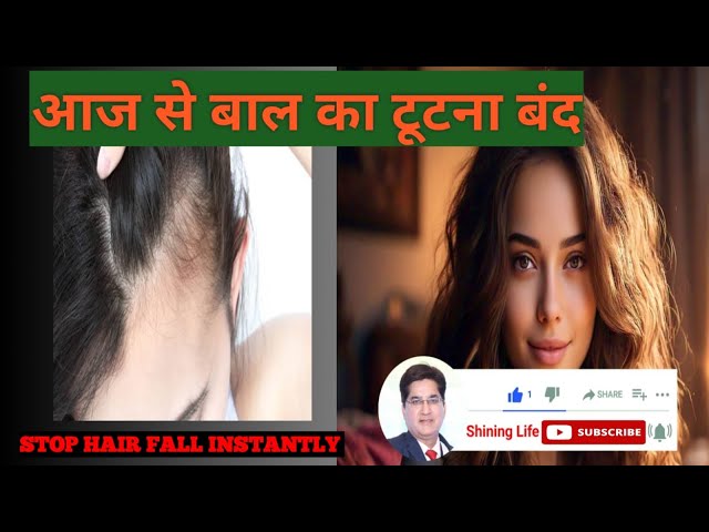 How To Stop Hair Fall/ Hair Fall Kise Roke🧑🏿‍🦰👱🏾‍♂️