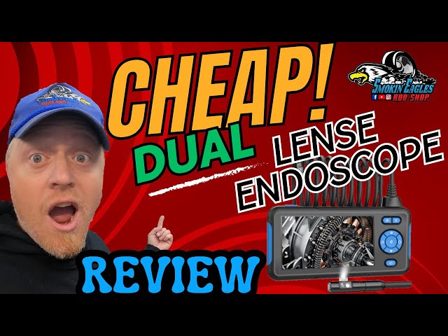 BUY THIS EndoScope Camera on Amazon!! #cheap #best #amazonfinds #amazon #amazongadgets