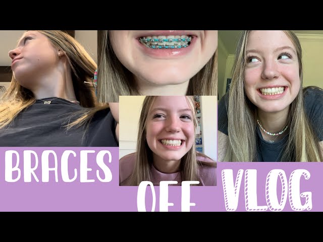 Braces Off Vlog! (getting my braces off!)