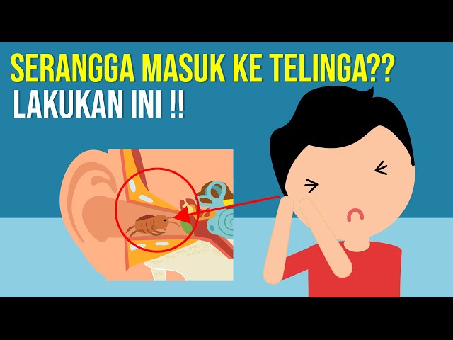 Serangga Masuk Ke Telinga? Lakukan Ini!!