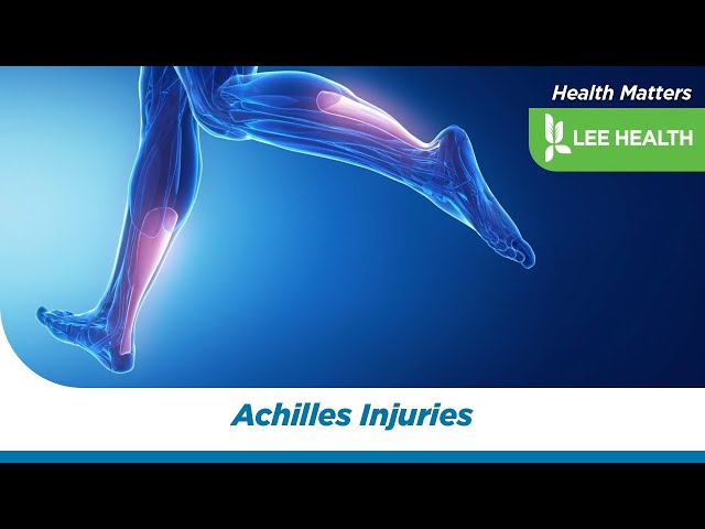 Achilles Injuries