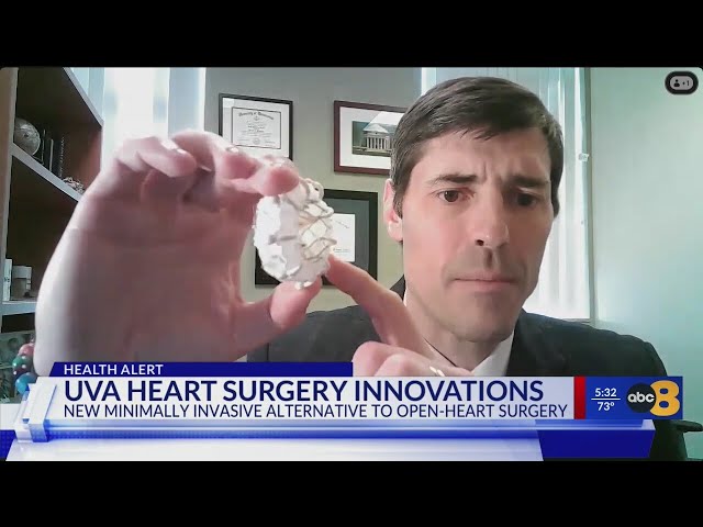 UVA's hospital first in Virginia to use new heart valve replacement procedure