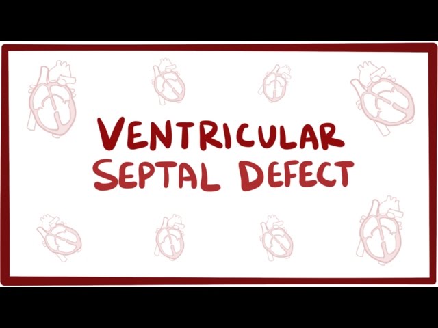 Ventricular septal defect (VSD) - repair, causes, symptoms & pathology