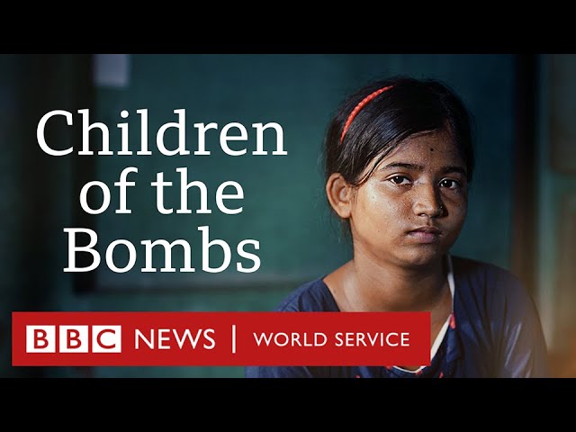 'No other child should be hurt like this' - Children of the Bombs - BBC World Service Documentaries