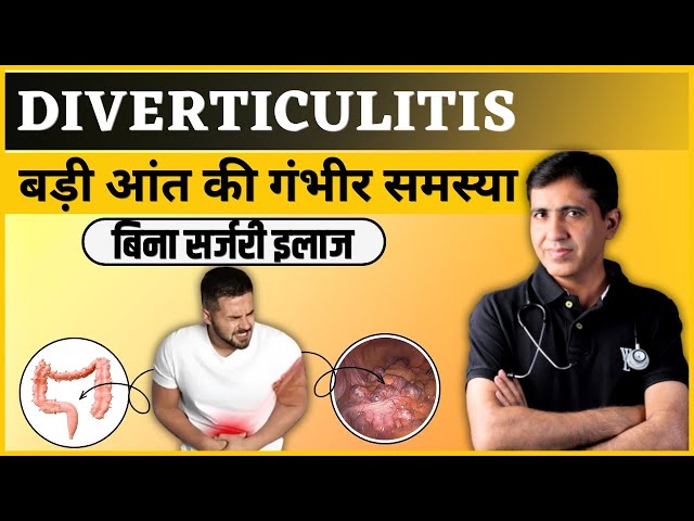 MIND-BLOWING Diverticulitis Secrets You Never Knew Existed